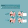 سرشیشه سیلیکونی دوعددی Teat Breastfeeding Adaptable سواوینکس Suavinex
