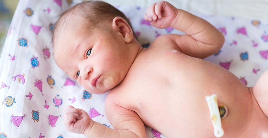 بند ناف نوزاد