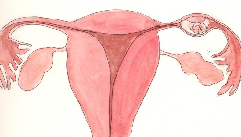 بارداری خارج از رحمی چیست؟