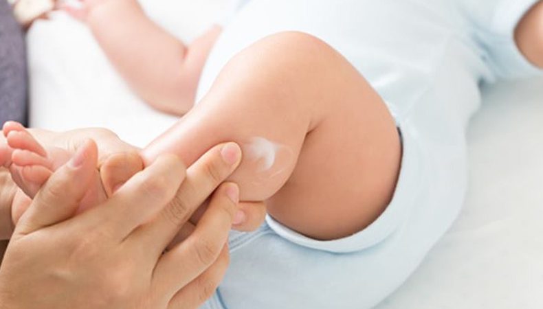 خشکی پوست نوزاد