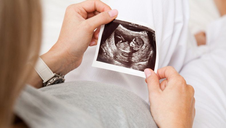 انواع سونوگرافی بارداری