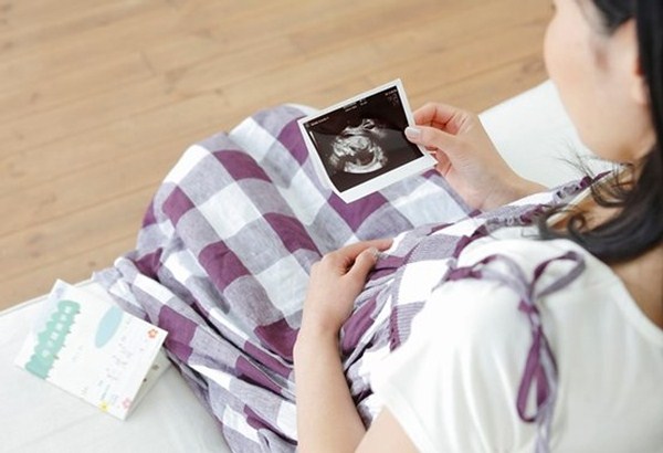 انواع سونوگرافی بارداری