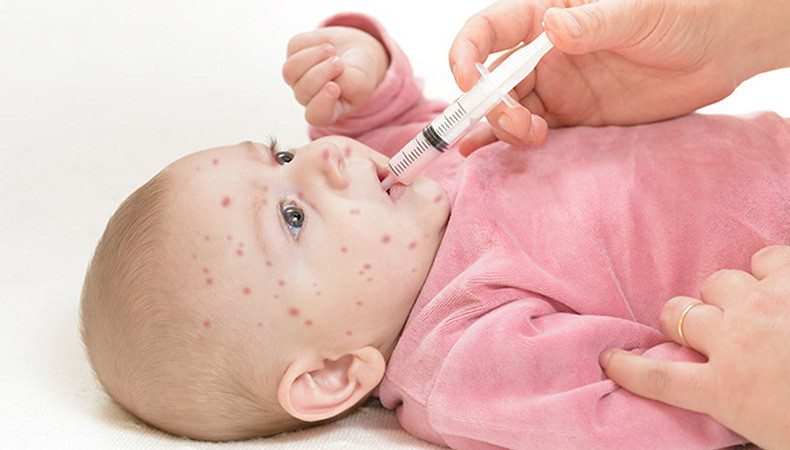 سرخک در نوزادان و کودکان