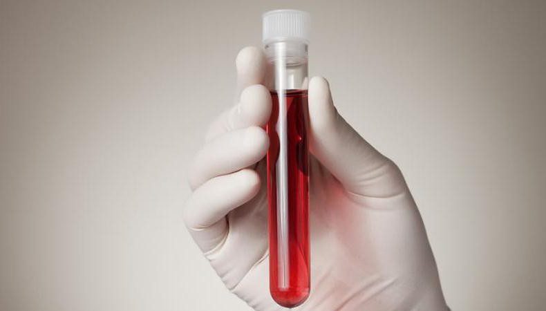 تست بارداری