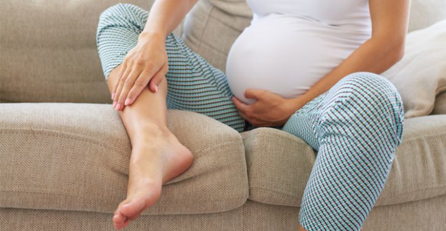 ورم پا مچ پا در دوران بارداری