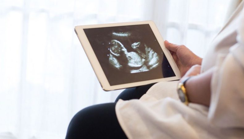 هفته بیستم بارداری